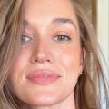 Jade Roper’s Scalp Cyst: A Look at Treatment Options and the Reality of Unexpected Health Challenges