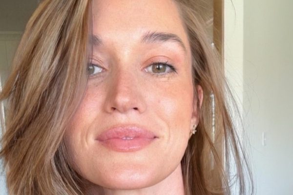 Jade Roper’s Scalp Cyst: A Look at Treatment Options and the Reality of Unexpected Health Challenges