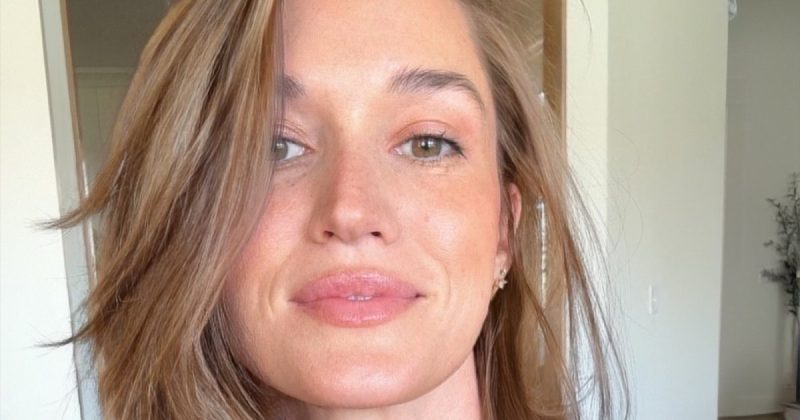 Jade Roper’s Scalp Cyst: A Look at Treatment Options and the Reality of Unexpected Health Challenges