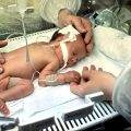 Saving Babies, One Test at a Time: A New Hope for Neonatal Sepsis