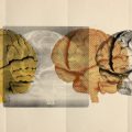 Unlocking Autism’s Mysteries: Four Distinct Subtypes Identified